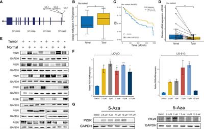 Polymeric immunoglobulin receptor suppresses colorectal cancer through the AKT-FOXO3/4 axis by downregulating LAMB3 expression